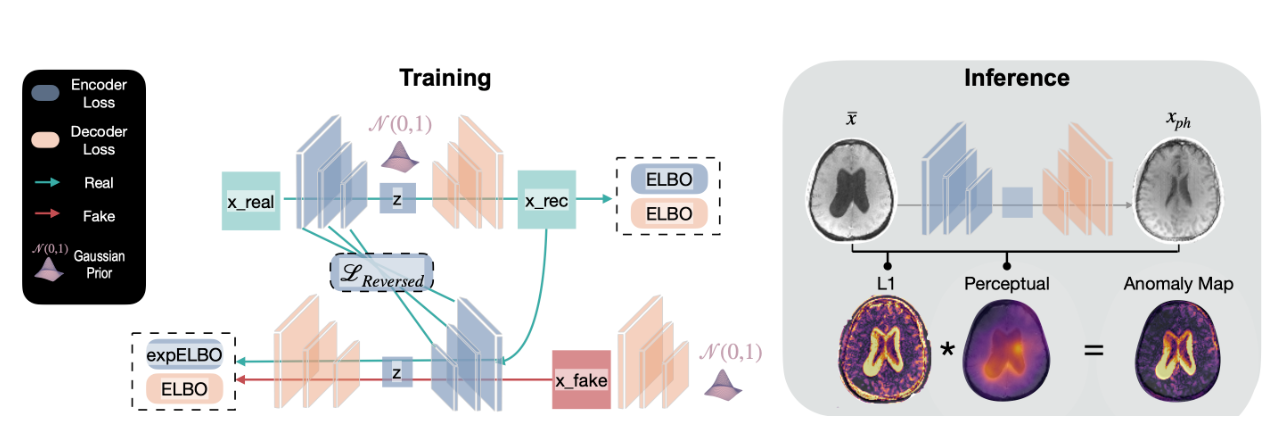 【论文阅读笔记】Towards Universal Unsupervised Anomaly Detection in Medical Imaging