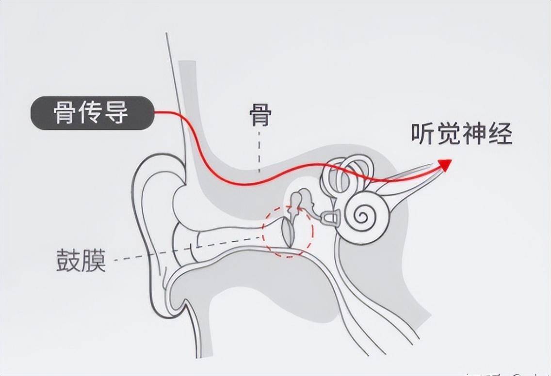 骨传导耳机通过实体传声原理工作,其声音振动在传递过程中不仅会通过