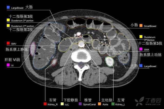 学习笔记:关于医学图像配准,以及腹部 CT、X线、MRI等图像的一些问题 持续更新_医学图像中的atlas代表什么-CSDN博客