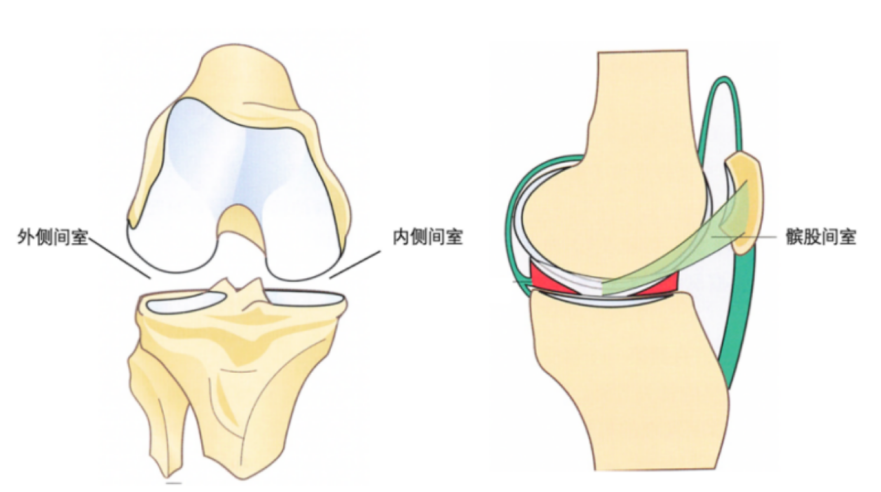 【惠友小课堂】膝关节可以只换一半？单髁置换术，哪里坏了修哪里，重塑新“膝”望