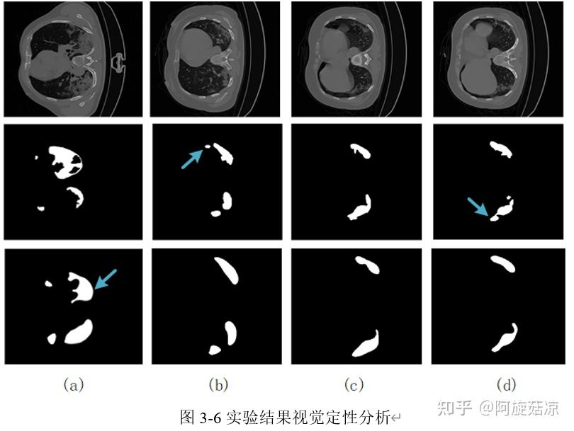 医学图像分割实操