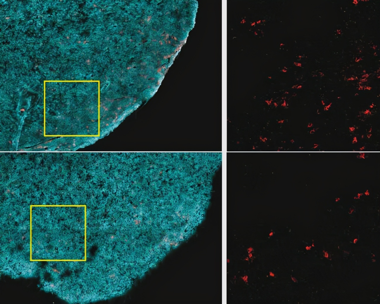 Why do we want to lose weight?  Scientists confirm that obesity may lead to cancer cell tumor growth