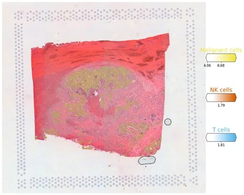 空间单细胞转录组cell2location分析流程学习