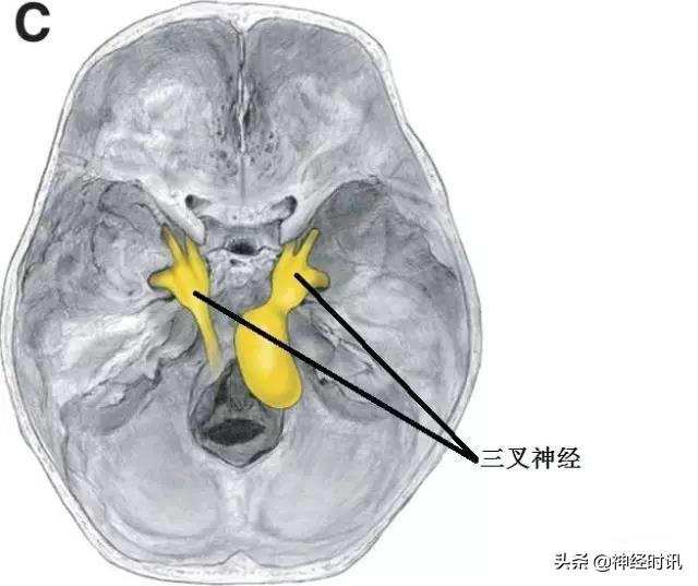 上项线体表位置体表神经解剖三叉神经详解