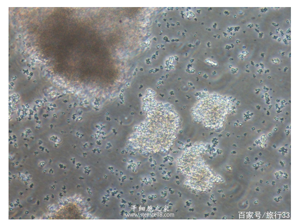 细胞培养常见污染图鉴