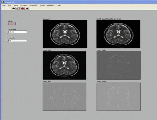 LabVIEW使用支持向量机对脑磁共振成像进行图像分类