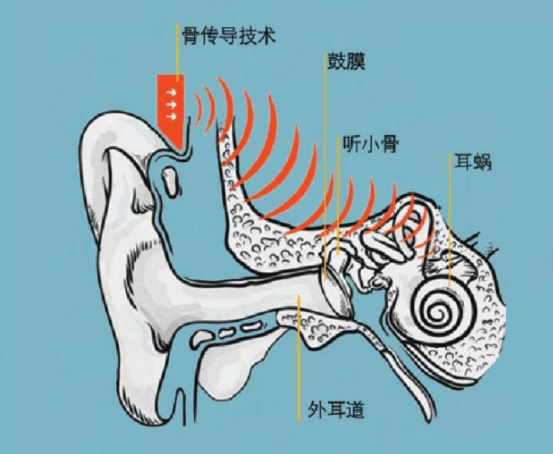 骨传导耳机效果怎么样,骨传导耳机有什么优劣势