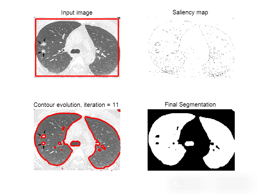 关于机器学习/深度学习的一些事-答知乎问（二）