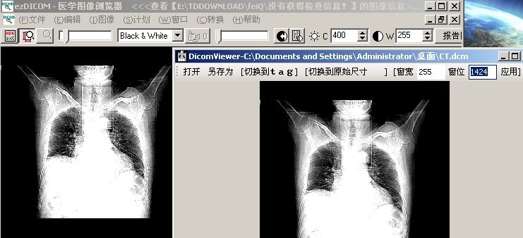 【转】Dicom格式文件解析器！！！！！！！