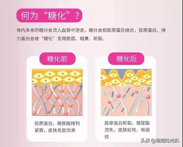 所谓的"糖化肌肤",其实指的是肌肤因为新陈代谢速度过慢,导致体内多余