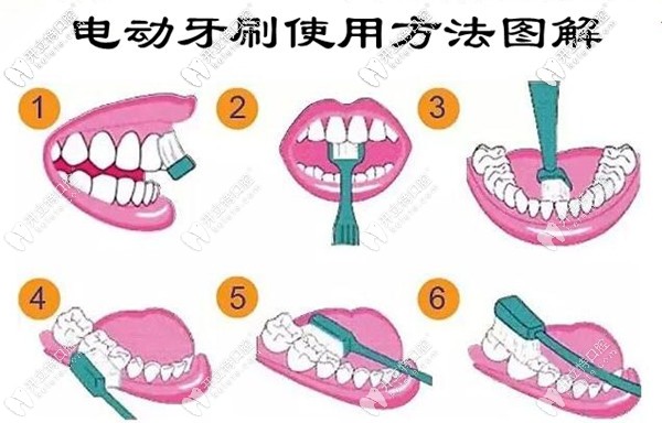 rsatool使用步驟圖解電動牙刷使用方法在此內含刷牙步驟的示範圖解哦