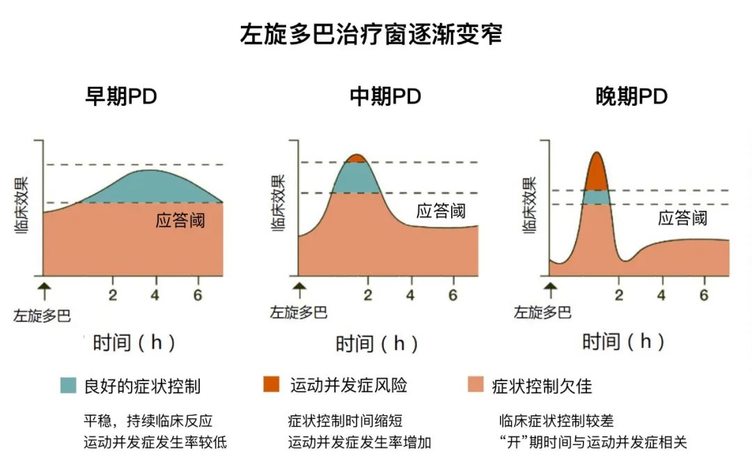 蜜月期是指在帕金森病初期或是中期的前几年服用较小剂量的左旋多巴