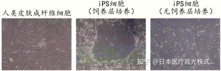Ips细胞对受损dna的修复保护机制 Bio12345的博客 Csdn博客