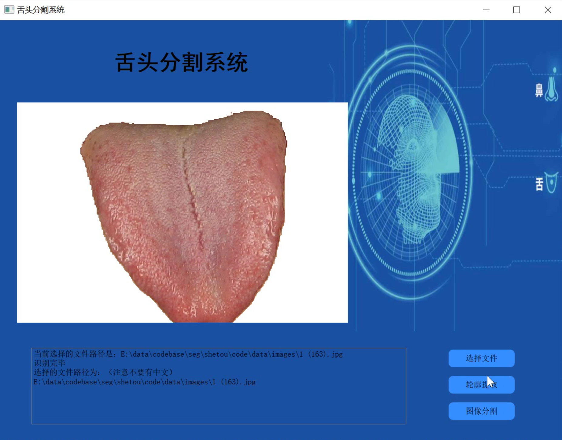 （有图）懂看舌象的朋友请进来看看 这种舌苔说明什么，要怎么恢复！_百度知道