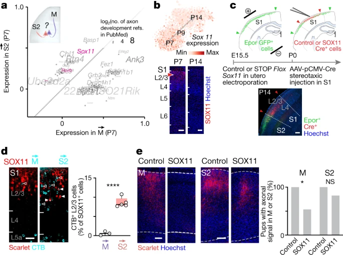 Figure 3. 出生后 SOX11 表达水平调节 S1 感觉运动连接
