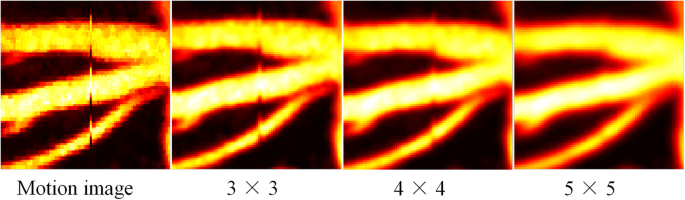 光学分辨率光声显微镜中基于深度学习的运动校正算法