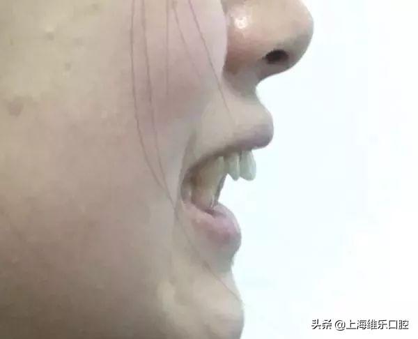 b4a5e454b795134d5229c5fa237c5142.png