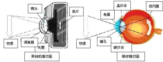 成都爱尔樊映川院长解析免散瞳眼底照相是什么？有啥作用