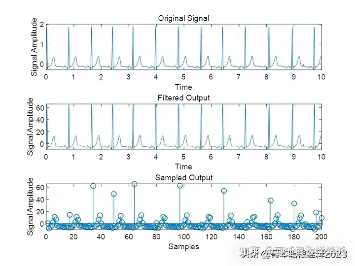 基于滤波器的心电信号降噪方法（MATLAB R2018）