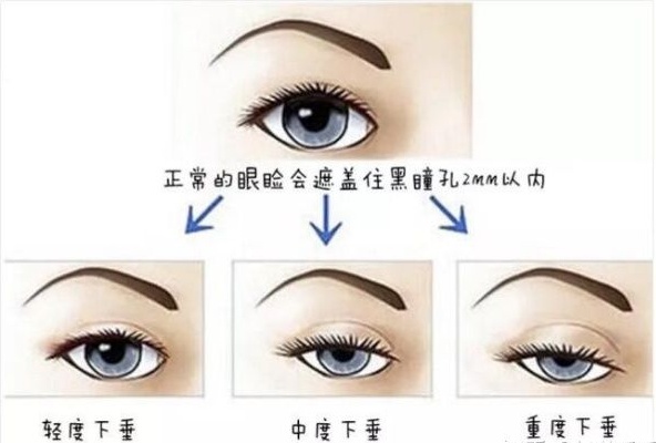 b8863342dca2bd8413db8352c7175b63.png