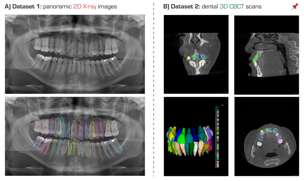 牙齿实例分割数据集2D和3D示例