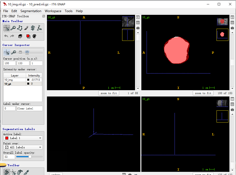 ITKSNAP基础教程_itk snapCSDN博客