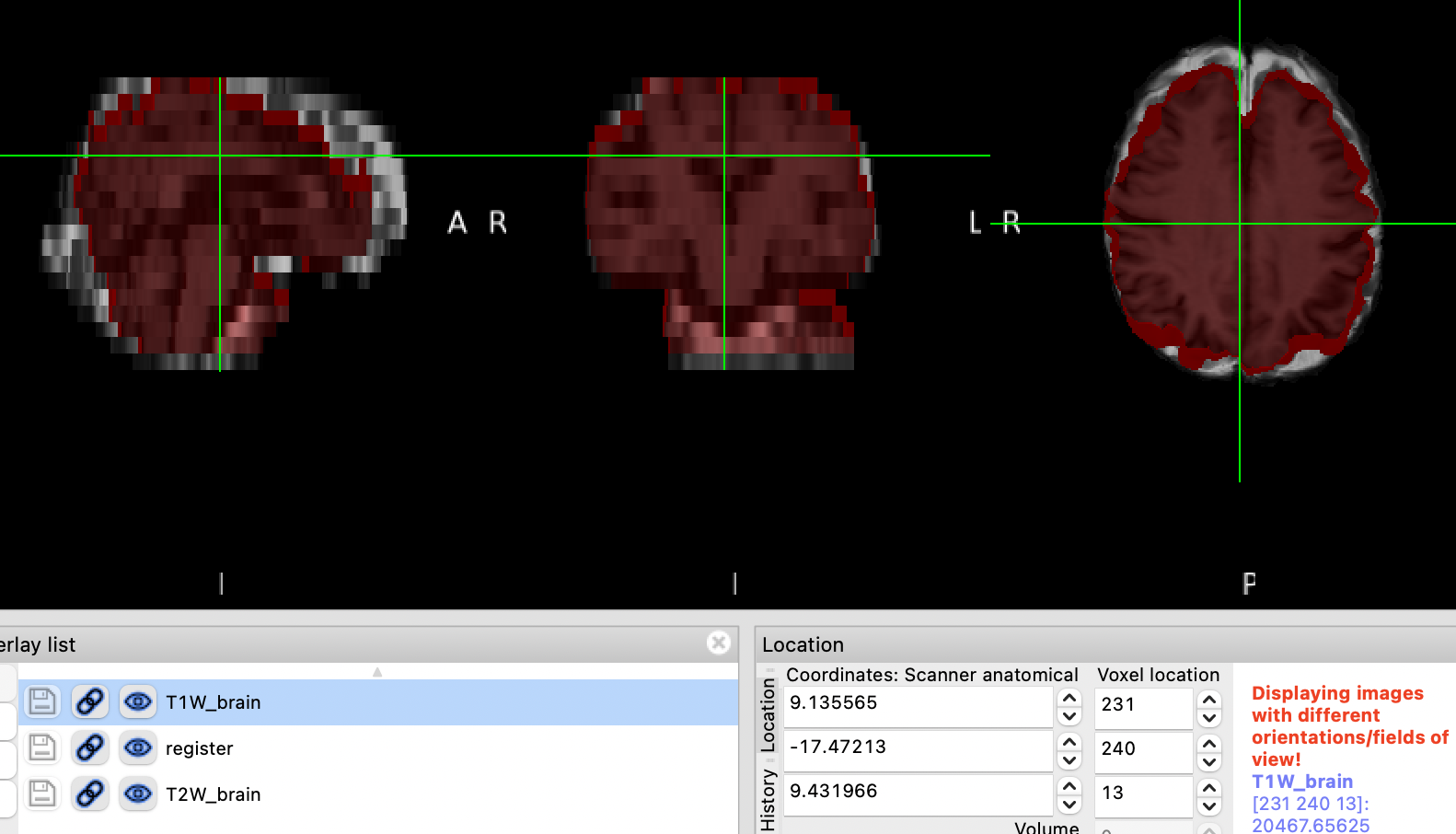 MRI多序列，多中心数据集预处理--使用FSL-Flirt 配准数据