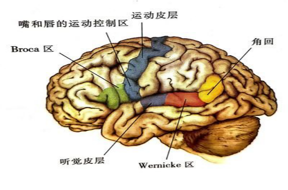 失语症6种类型图片图片