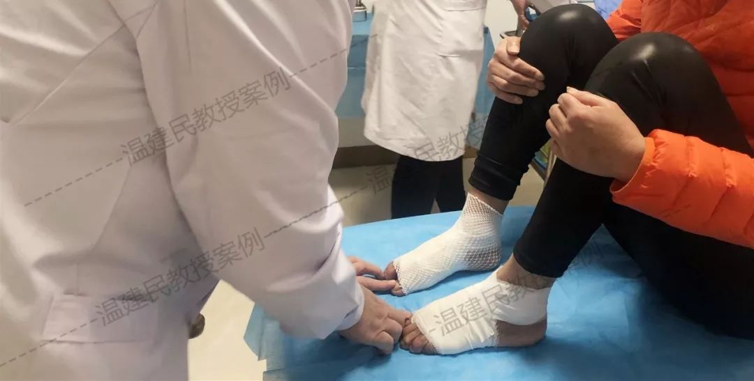 带防夹功能的升降器原理_温氏拇外翻疗法术后包扎有妙招,活用小夹板