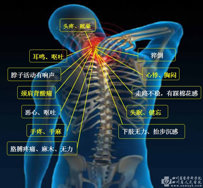 健康科普-康复科（川港康复中心）-科室设置-四川省医学科学院·四川省人民医院【官方网站】