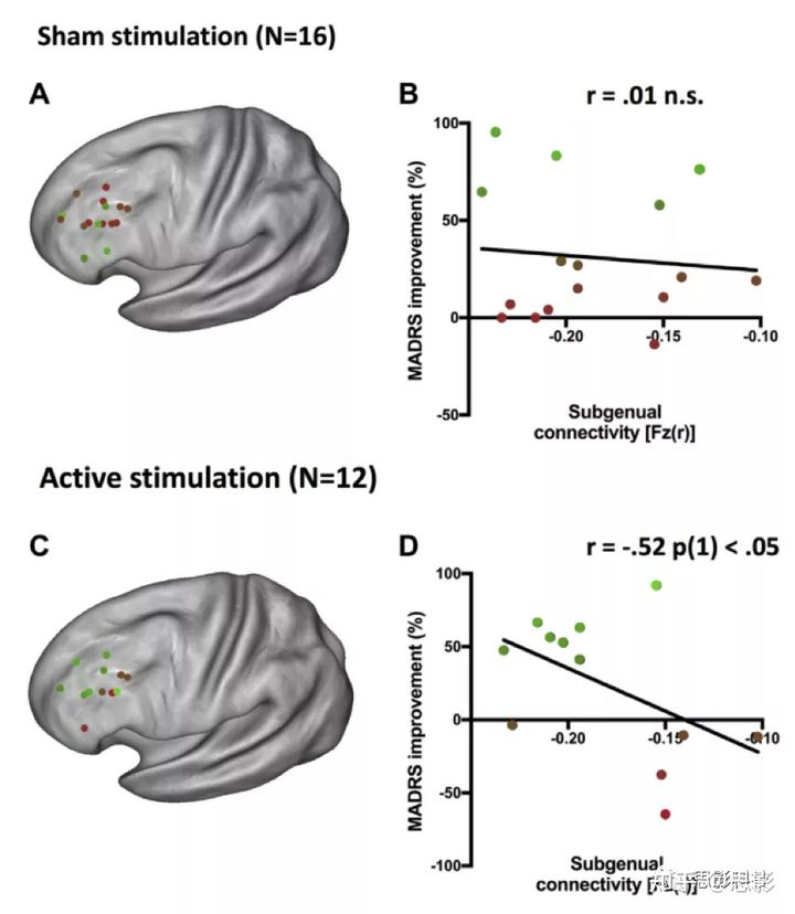 Biological Psychiatry：亚属连接预测经颅磁刺激位点抗抑郁疗效