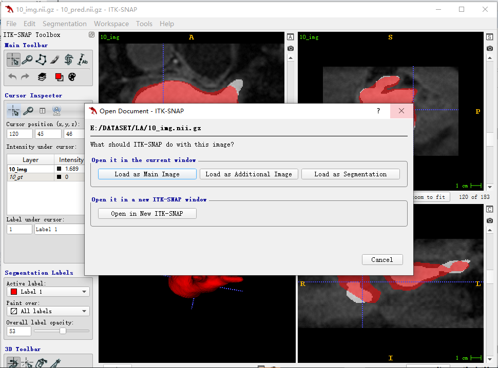 ITKSNAP基础教程_itk snapCSDN博客