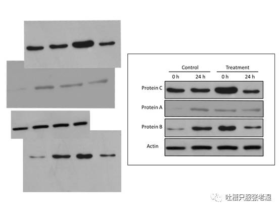 westernblot电泳图可能是生命科学实验中最常见的结果图片了,从成像仪