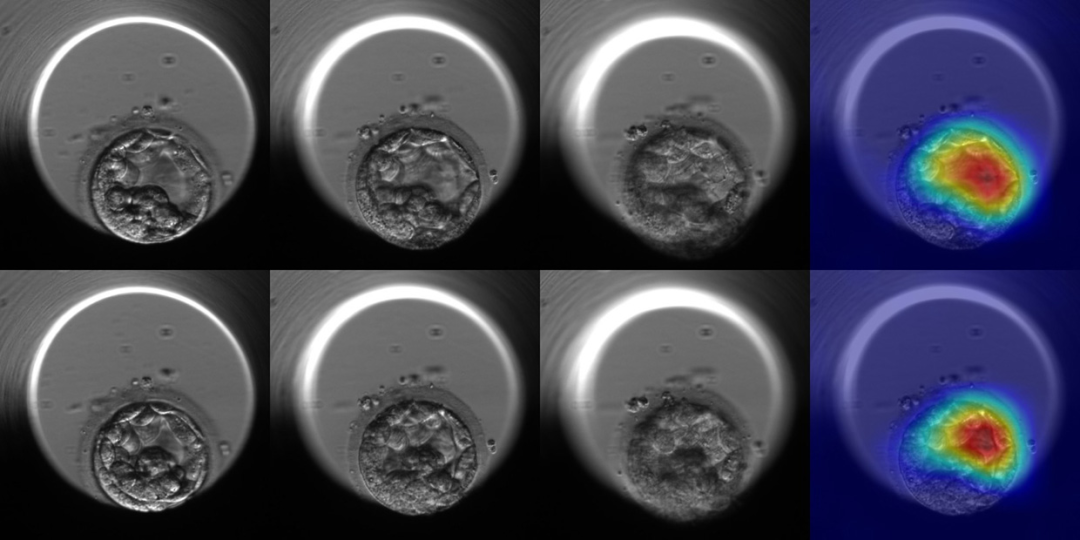 ai赐子学习数百万个胚胎发育过程算法可将试管婴儿成功率提高3倍