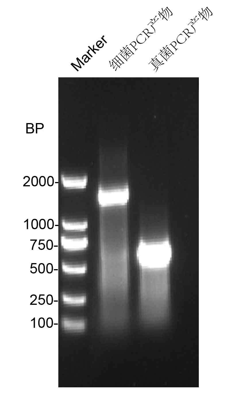菌鉴定-微生物鉴定结果分析-CSDN博客