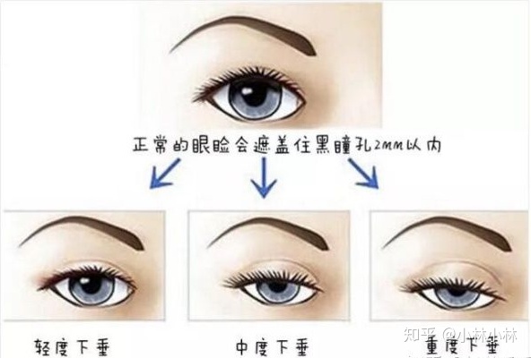 c8378a1922d1b7f61559b1c15ffc99bd.png