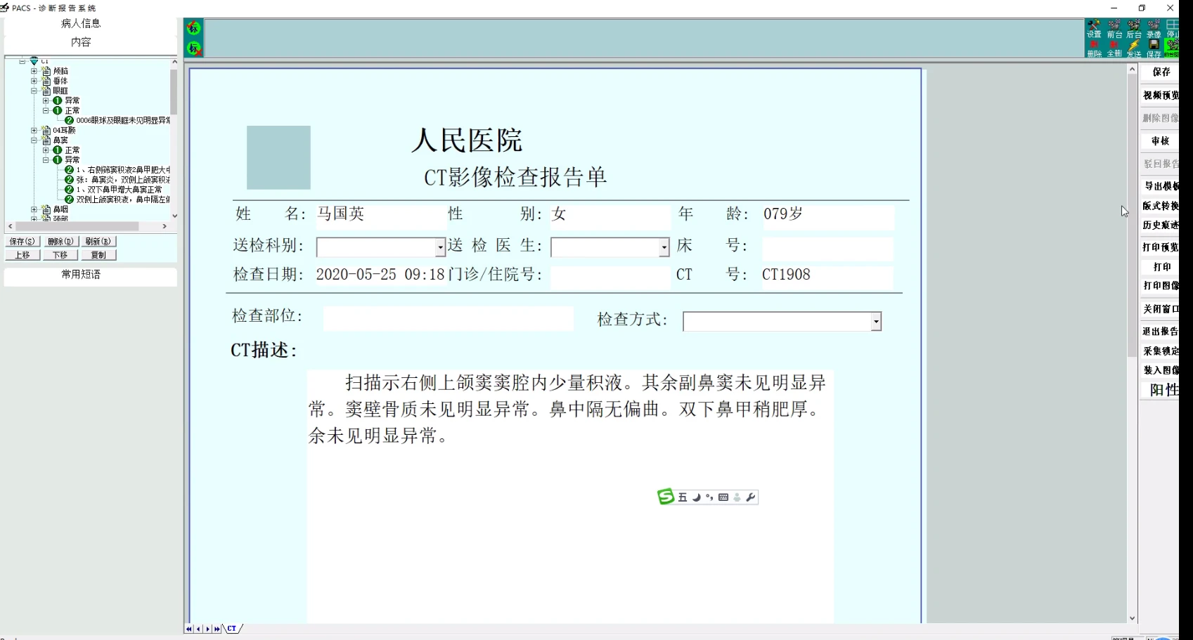 影像科室图像存储与传输系统源码 智能化影像报告系统源码