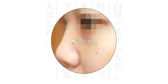 ca2482b6cbe6e0562abc37079b7cf81e.png