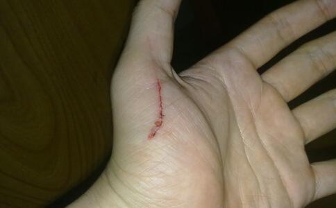 多恐怖了,相信大部分的小伙伴或多或少都被钢卷尺在手上划出过口子吧