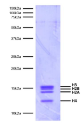 Epicypher热销产品——Mononucleosomes, Recombinant Human