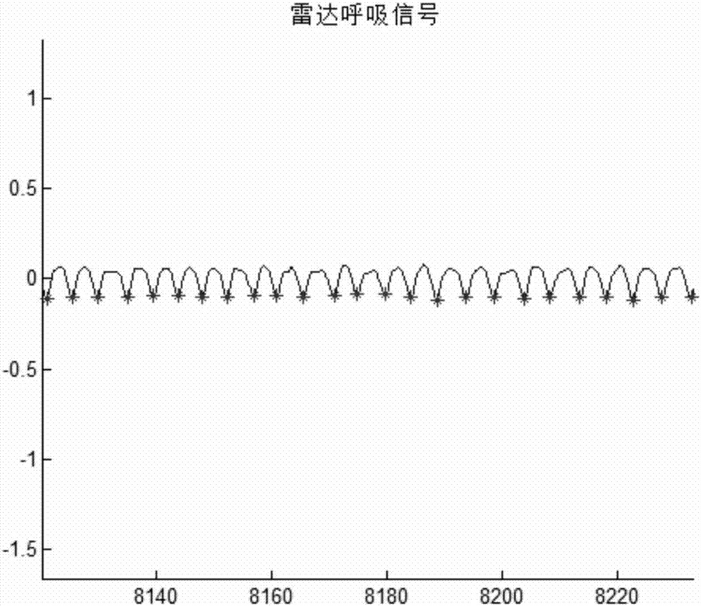 睡眠分期matlab代码,非接触式睡眠分期方法与流程