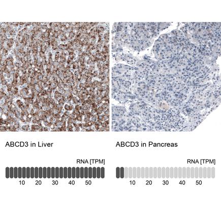 Anti-ABCD3 Antibody-Monoclonal Antibody against Human ABCD3