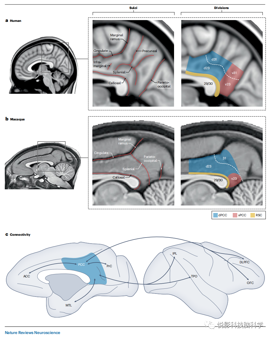Nature reviews neuroscience:后扣带皮层的三分观点_扣带回-CSDN博客