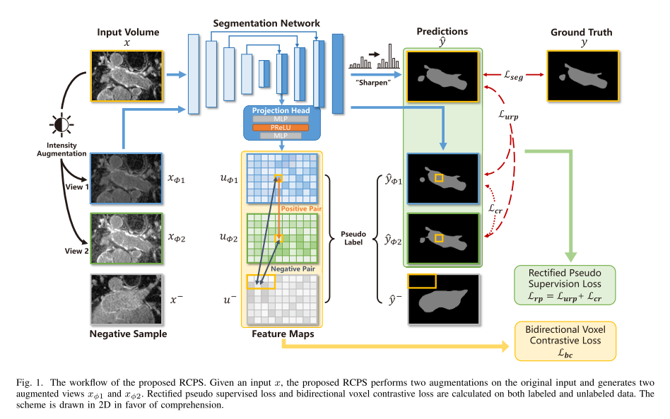【半监督医学图像分割 2023】RCPS