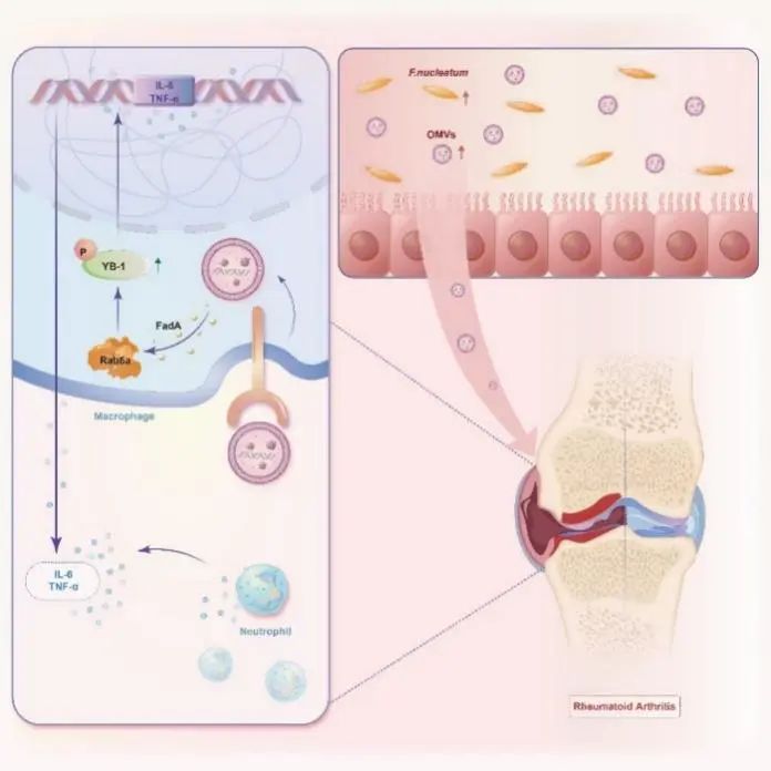 Cell Host  Microbe｜李娟/周宏伟团队揭示肠道菌群来源外膜囊泡促进类风湿关节炎发病新机制...