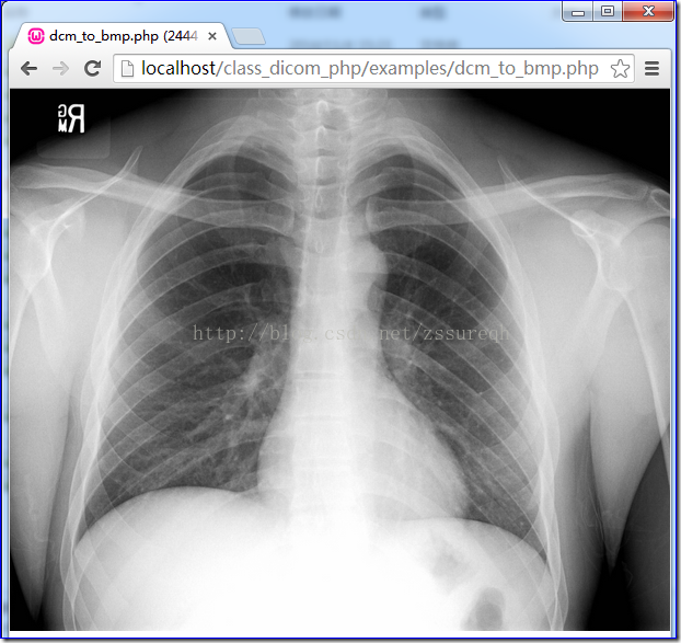 php pacs,DICOM医学图像处理：WEB PACS初谈四，PHP DICOM Class – 只要踏出一步，路就在前方——zssure – CSDN博客...