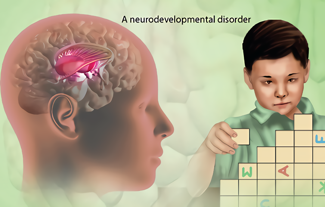 自闭症似乎被普遍用于概括一大类定义不明的表型 (the autistic