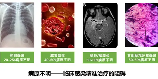 医学专题--多组学在病原微生物感染中的研究思路-CSDN博客