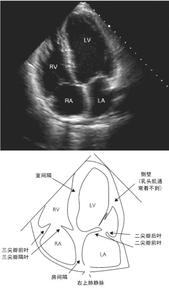 心脏彩超四腔心解剖图图片