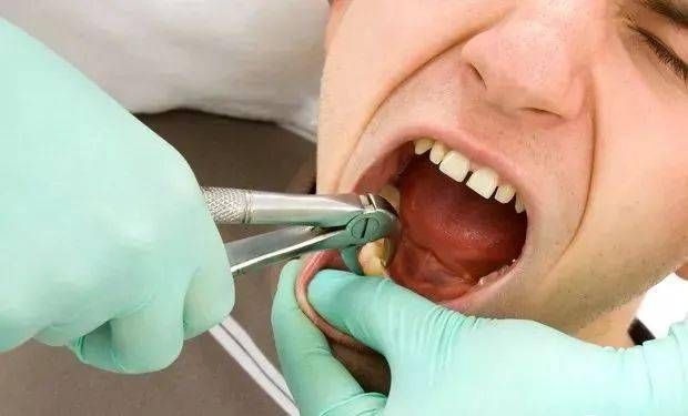 拔牙护理：让孩子轻松迎接新牙成长的注意事项